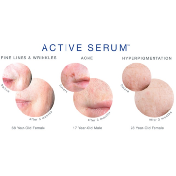 IS CLINICAL Active Serum - Tinh chất đặc trị mụn, lỗ chân lông & dầu thừa image 3