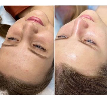 IS CLINICAL Hydra-Cool Serum - Tinh chất cấp nước, dưỡng ẩm & làm dịu da image 2