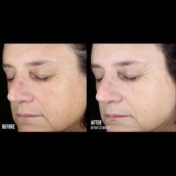 SKINBETTER Even Tone Correcting Serum - Tinh chất trị đốm nâu image 4