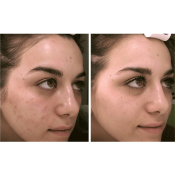 IS CLINICAL Cleansing Complex Mini - Sữa rửa mặt image 4