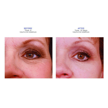 IS CLINICAL Youth Eye Complexe - Kem mắt trị nhăn, xoá thâm & trẻ hoá image 4