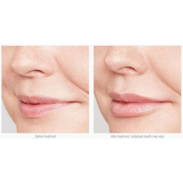 IS CLINICAL Lip Duo - Bộ tẩy tế bào chết & dưỡng môi image 4