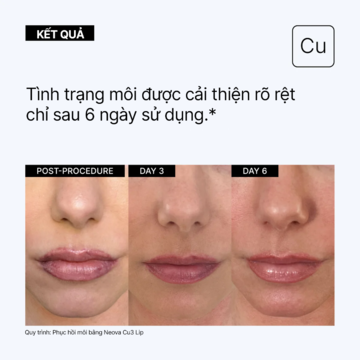 NEOVA Cu3 Lip Repair - Kem dưỡng môi làm mềm & căng mọng image 3