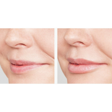 IS CLINICAL Youth Lip Elixir - Serum dưỡng môi image 2