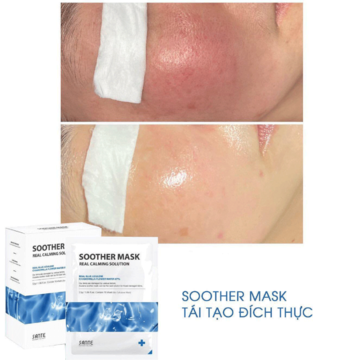 SANTE Azulene Soother Mask - Mặt nạ phục hồi image 2