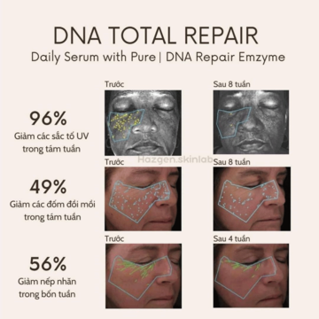 NEOVA DNA Total Repair - Serum chứa enzymn DNA tinh khiết & siêu phức hợp chống oxy hoá, xoá nhăn, giảm nám image 3