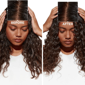 KERASTASE Symbiose Bain Purete Anti-Pelliculaire - Dầu gội trị nấm vảy gàu image 3