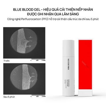 NEODERMA Blue Blood Gel Youth Infuser - Gel tái tạo, khôi phục hàng rào bảo vệ và trẻ hoá da image 2