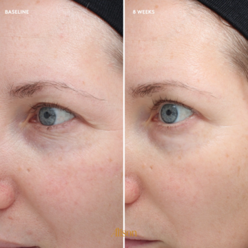 Colorescience Total Eye Firm & Repair Cream - Kem dưỡng & chống lão hoá vùng mắt image 4