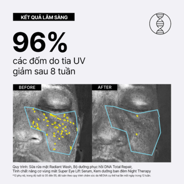 Neova DNA Total Repair - Serum chứa enzymn DNA tinh khiết & siêu phức hợp chống oxy hoá, xoá nhăn, giảm nám image 4