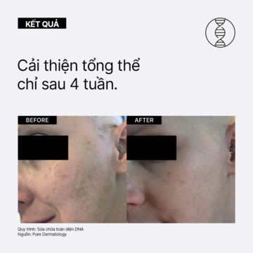 Neova DNA Total Repair - Serum chứa enzymn DNA tinh khiết & siêu phức hợp chống oxy hoá, xoá nhăn, giảm nám image 6