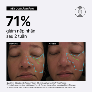 Neova DNA Total Repair - Serum chứa enzymn DNA tinh khiết & siêu phức hợp chống oxy hoá, xoá nhăn, giảm nám image 3