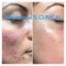 IS CLINICAL Pro-Heal Serum Advance+ - Tinh chất trị mụn, giảm thâm, làm dịu kích ứng & chống lão hoá small image 