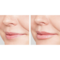 IS CLINICAL Youth Lip Elixir - Serum dưỡng môi small image
